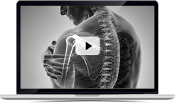 Patient Education Videos Steven E. Flores, M.D. Board Certified Orthopedic Surgeon & Sports Medicine