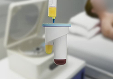 Platelet Rich Plasma/PRP